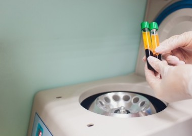 04. PRP ve CGF Kitleri